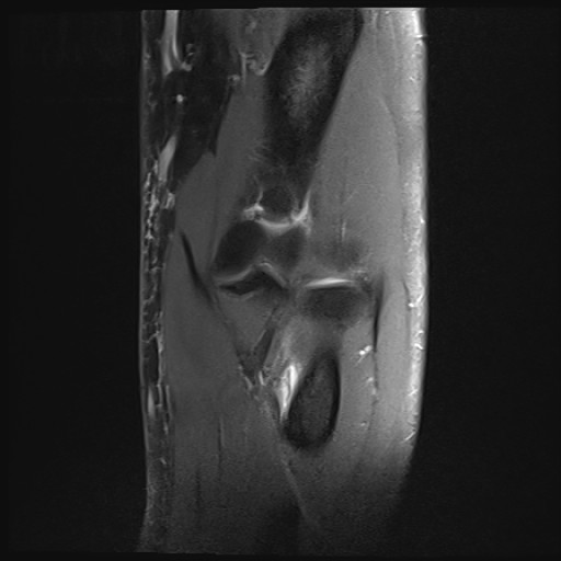 Click on the Serie image to view the images of Wieszt, Gnter